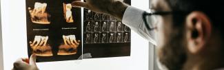 teeth xrays